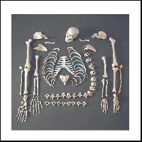 人类骨骼Dis-articulated