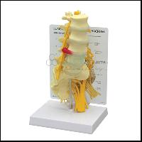 腰椎和骶骨模型